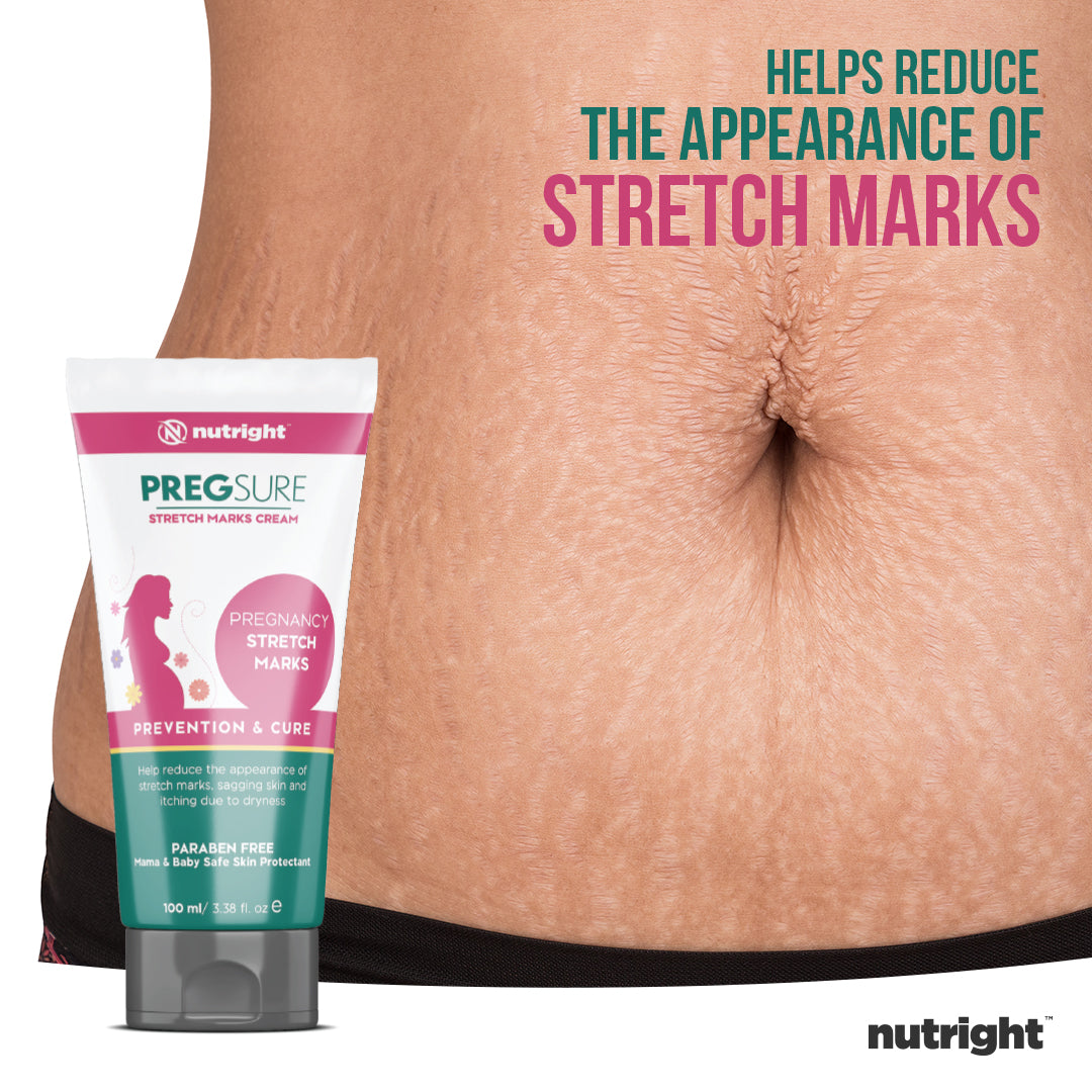 PregSure Stretch Mark Removal Cream – Advanced Skin Restoring Formula