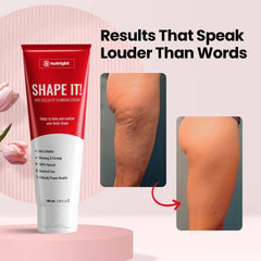 Shape It - Anti-Cellulite Slimming Cream